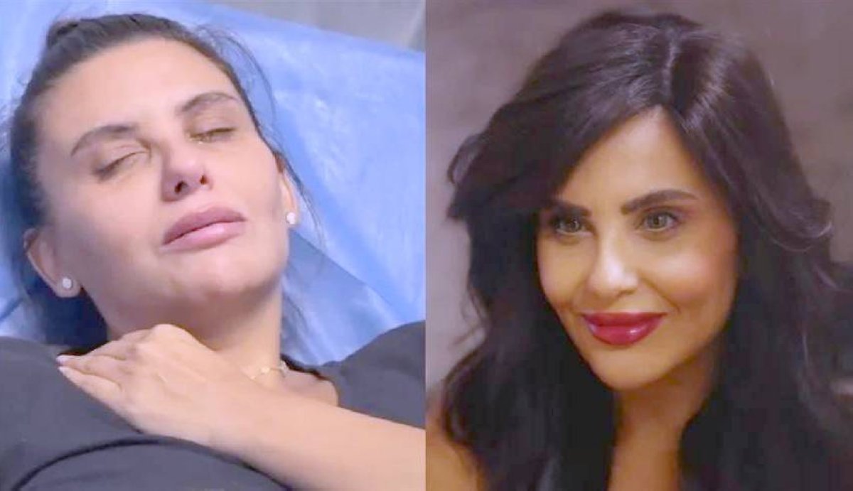 حقن التجميل تُطيح بعافية دانا حمدان – أخبار السعودية